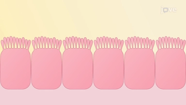 article